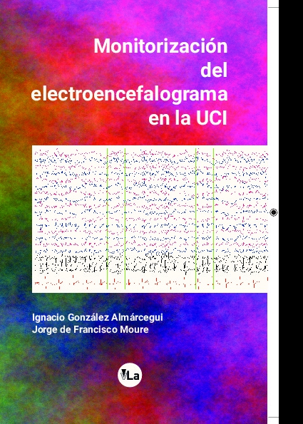 Monitorización del electroencefalograma en la UCI